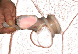 Passer le penis dans la cage de chastet�