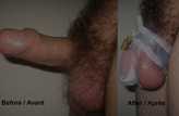 Alexis, Belgium - Birdlocked Male Chastity Device
